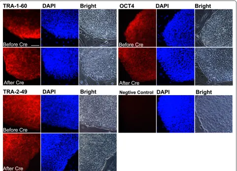 Figure 2 Expression pluripotency markers by SCAP iPSCs in vitro. Embryonic stem cell-associated genes TRA-1-60, TRA-2-49 and OCT4expressed by SCAP iPSCs before and after Cre-excision
