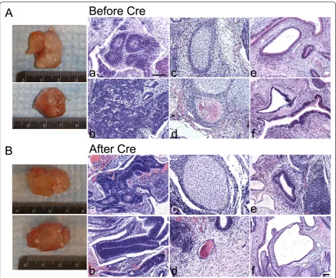 Figure 3 Histological analysis of teratomas. Images of removed teratomas from mice are shown on the left of the image panels