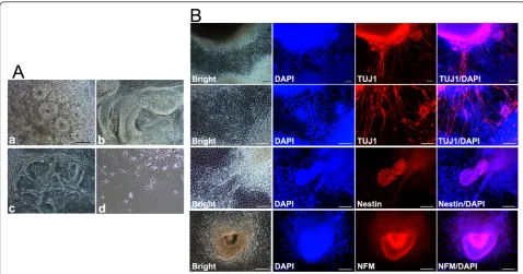 Figure 4 EB-mediated neural differentiation of TF-SCAP iPSCspositive for nestin and NFM