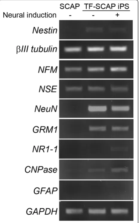 Figure 5 RT-PCR analysis of the expression of neural markersThe neurogenic induction followed the same method as that forsamples shown in Figure 4