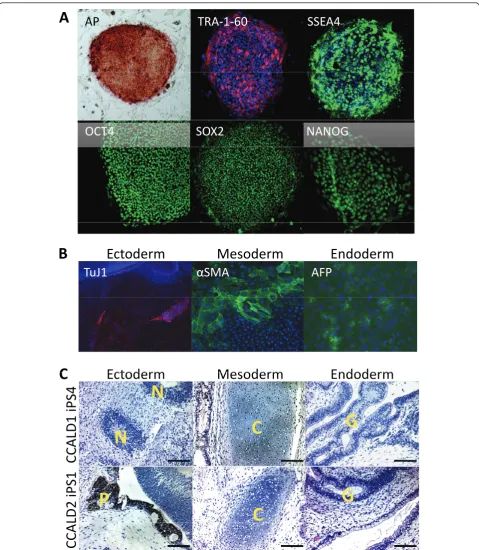 Figure 1 Characterization of iPSCs from patient with CCALD. (A) Representative images of alkaline phosphatase (AP) staining andpluripotency protein biomarker immunostaining analysis of childhood cerebral adrenoleukodystrophy (CCALD) patient induced pluripo