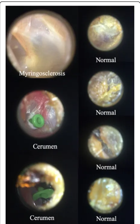 Fig. 2 Misclassifications made by neural network (incorrect diagnosison image)