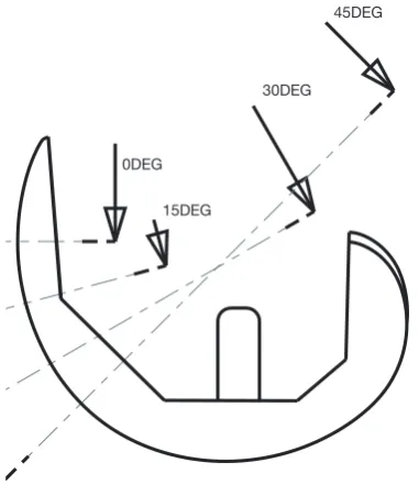 Figure 2 Illustration of trochlear profiles measured as viewed in the sagittal plane.