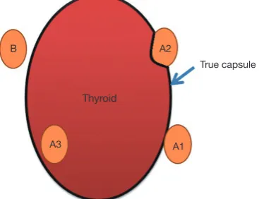 Figure 1 Positional relationship of parathyroid glands.
