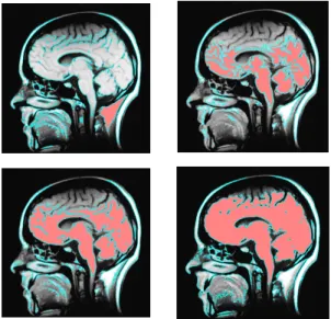 Fig. 3. Selected brain imaging 