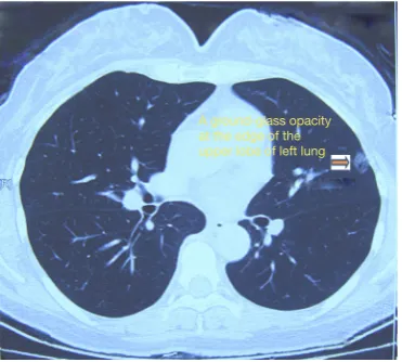 Figure 3 The patient’s position: in the right lateral decubitus position and in a Jackknife position.