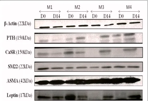 Figure 5 Western blot analysis showing differentiation markers of osteogenic, vascular smooth muscle, and adipogenic lineagesexpressed by BM-derived MSCs cultured in different expansion media(10% HPL), and M4 (5% HPL)