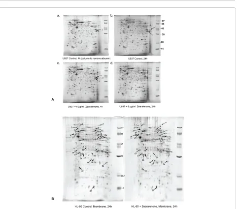 Figure 6 Effect of zearalenone (ZEA) on activation of caspase-3 and caspase-8. Activity of caspase-3 and caspase-8 of HL-60 (A) and U937(B) cells treated for 24 h with various concentrations of ZEA were measured using specific substrate analogs as describe