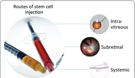 Figure 1. Routes of stem cell injection for retinal diseases.