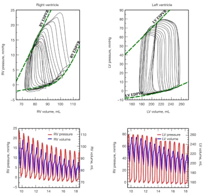 Figure 2 Simultaneous right and left ventricular pressure-volume (PV) loops during an inferior vena cava occlusion