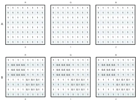 Figure 6 The visualization matrix of the visual field damage area. (A) 8*8 RGB matrix; (B) matrix filled by quintuples.