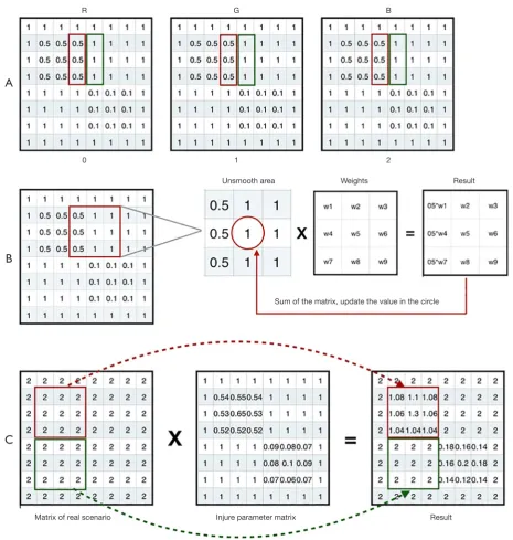 Figure 7 The Gaussian smoothing filtering in the visualization matrix of the visual field damage area