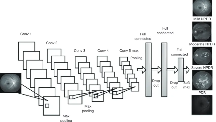 Figure 3 Fundus retina detection using deep learning network.