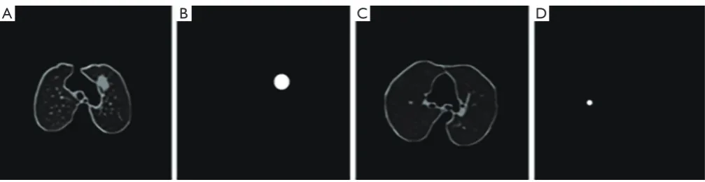 Figure 4 Image processed by the ACE algorithm. (A) represents the picture before processing, and (B) represents the processed picture; (C,D) is also similar