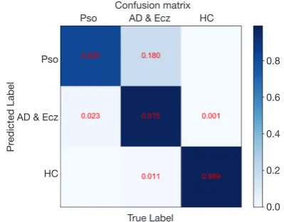 Figure 4 t-SNE visualization of clusters in the CNN for 3 categories. The trained CNN’s internal representation of 3 disease classes in fold-4 by applying t-SNE, a method for visualizing high-dimensional data, to the last hidden layer representation (1792-
