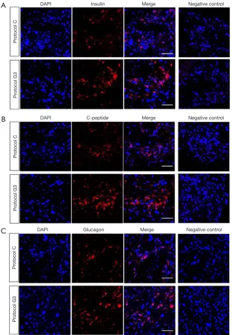 Figure 3 Immunofluorescence staining of insulin, C-peptide, and glucagon in IPCs differentiated from hADSCs