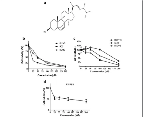 Figure 1 Cytotoxic effect of EP against DU 145 prostate cancer cells. The cells were treated with various concentrations of EP (0, 25, 50, 100,and 200 μM/mL) for 72 h