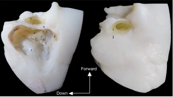 Figure 1 The bi-material 3D-printed temporal bone in operating position. Left: dissected model with identification of both hard: a: cortical bone; b: short process of the incus; c: external semi-circular canal) and soft (d: facial nerve; e: digastric crest