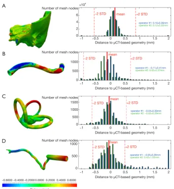Figure 6 Distances between the rough reconstructed geometry issued from manual segmentation of the DICOM files and the STL mesh files corrected and prepared for 3D printing, for temporal bone (A), sinus (B), vestibule/semicircular canals (C) and facial nerve (D).