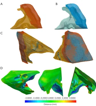 Figure 9 Quantitative comparison between STL files geometry sent to the printing machine, and the actual TB model issued from µCT reconstructions for both soft and hard materials.