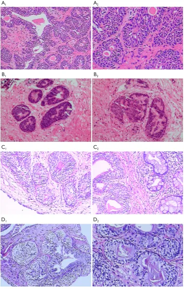 Figure 6 Pathological features of the intestinal and typical CG in HE stained sections