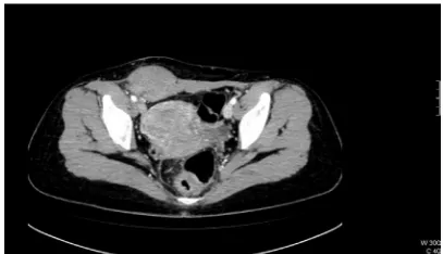 Figure 1 Preoperative imaging examination.