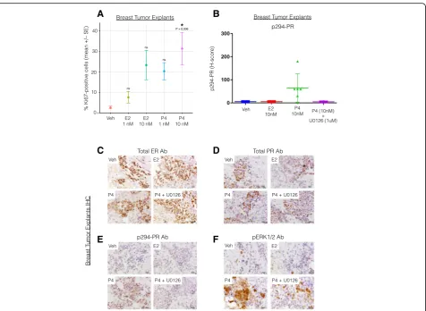 Fig. 3 Proliferation and biomarker expression in breast tumor explants in response to estrogen (E2), progesterone (P4), or combined P4 + U0126treatment