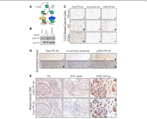 Fig. 1 Total PR and phospho-Ser294 PR IHC staining in cell lines, tissue sections, and a breast cancer tissue microarray.scoring classification: (cell lines by western blotting, with and without progestin R5020 treatment.ligand/kinase-dependent Ser294 phos