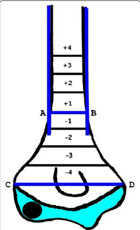 Fig. 1 Schematic representation of the exit zones of the proximallateral pins. Line AB represents the upper border of themetaphyseal-diaphyseal junction (MDJ) region