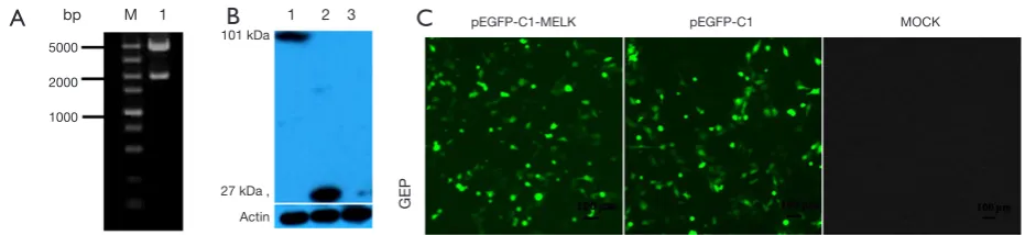 Figure 3 The identification, expression, subcellular localization of pEGFP-C1-MELK (A) Gel electrophoresis of the recombinant pEGFP-C1-MELK plasmid digested with EcoRI and KpnI