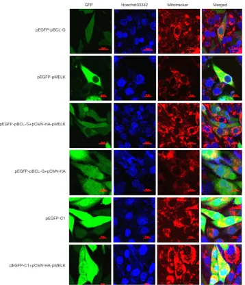 Figure 4 pMELK affects the subcellular localization of the pBCL-G protein. Subcellular localization of GFP-pBCL-G protein was detected by confocal microscopy before and after transfection with pCMV-HA-pMELK or the pCMV-HA empty vector