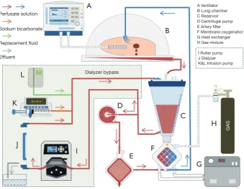 Figure 1 Circuit diagram shows the perfusate purification during ex vivo lung perfusion