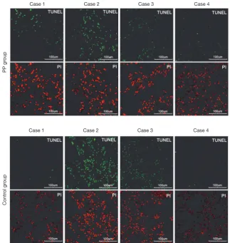 Figure 5 Representative images of TUNEL assay of different cases.