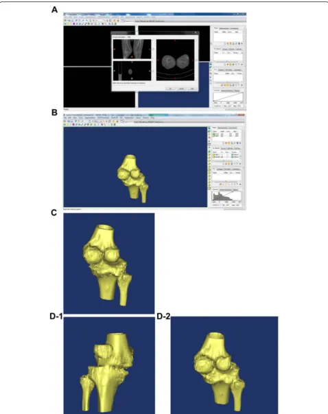 Fig. 1 Ajoint generated via Mimics software. Knee joint image generated Input data into Mimics software imaging