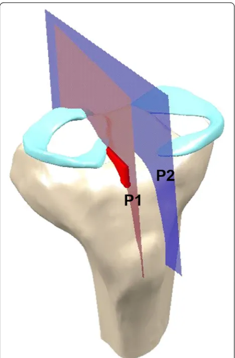 Fig. 3 Methodology for the 3D modeling of the intact knee. a 3D bone reconstruction. b 3D soft tissue and ligament reconstruction