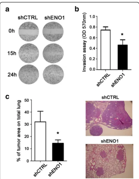 Fig. 7 ENO1 silencing affects in vitro and in vivo cell migration andlung are shown for each group of mice (invasion