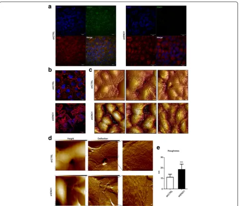 Fig. 2 Morphological analysis and roughness measurements of shENO1 cells.actin (Phalloidin-TRITC,level of nuclei