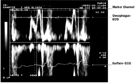 Figure 1Measurement of the IACT in the VDD - Mode = MA-LAMeasurement of the IACT in the VDD - Mode = MA-LA