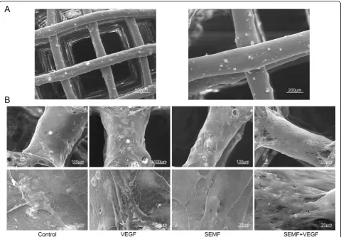 Fig. 5 SEM morphology of the polycaprolactone/hydroxyapatite scaffold (a). Scale bar, 500 μm and 200 μm