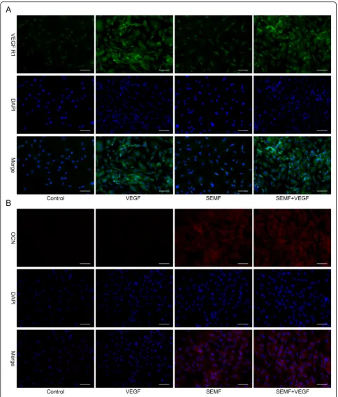 Fig. 4 The expression of VEGFR1 (green) and OCN (red) in rBMSCs after 7 days stimulation of VEGF and SEMF were observed byimmunofluorescence staining (a, b)