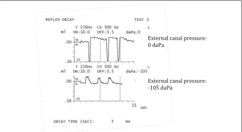 Fig. 1 Modified reflex decay test findings used to identify voluntary TT contraction in the test subjects