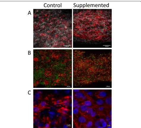 Fig. 2 Organization and microstructure of hECTs. Representative microscopy images of hECTs obtained along the horizontal axis of the hECT.max projection showing Cardiac Troponin T (red), and nuclei stained with anti-histone H2B (green), scale bar = 100show