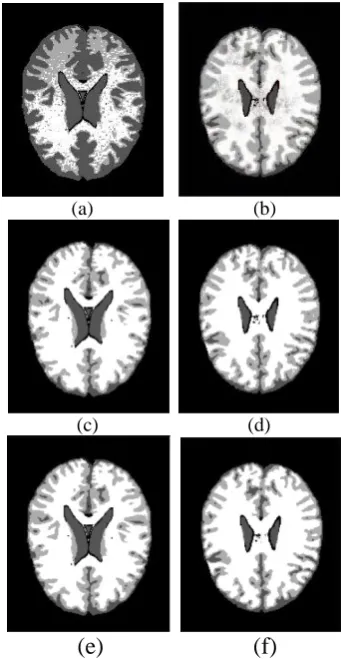 Fig. 2.  IBSR brain MRI and ground truth: (a) IBSR 155 (b) ground truth of IBSR 155 (c) IBSR 167   (d) 