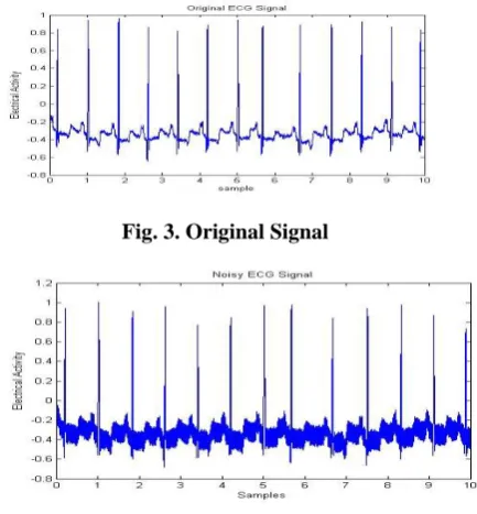 Fig. 3. Original Signal 