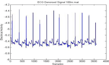 Fig. 5. Denoised ECG signal by above algorithm 