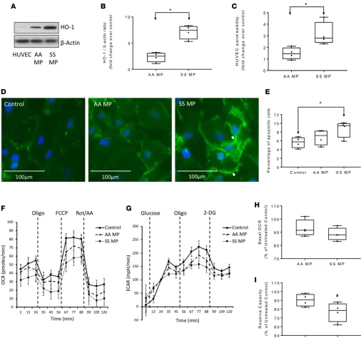 Figure 7. Townes-SS RBC–derived microparticles promote toxicity in human endothelial cells