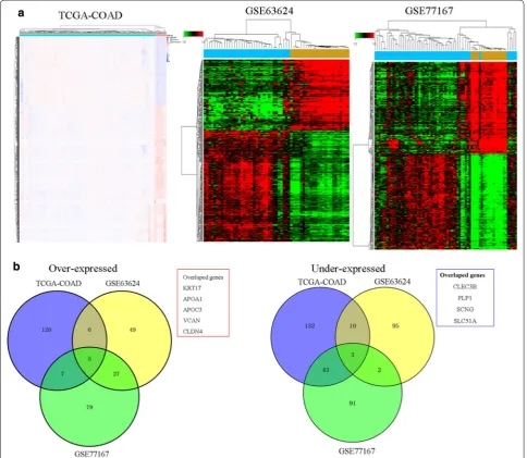 Fig. 1 Identification of differently expressed genes (DEGs) in human colon cancer (a) hierarchical clustering analysis of genes that were differentially expressed (fold change > 4; P < 0.05) in colon cancer and normal tissues (b) overlap of misregulated genes in TCGA data and GEO datasets