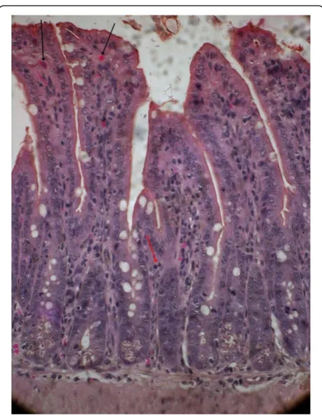 Figure 4 Mice intestine on 11th day after 2nd challenge of00611 strain showing grossly altered villous architecture,ruptured surface epithelium (black arrow), oedematous &congested lamina propria and submucosa (yellow arrow) withinflammatory cells (Hematoxylin & Eosin stain)-40x.
