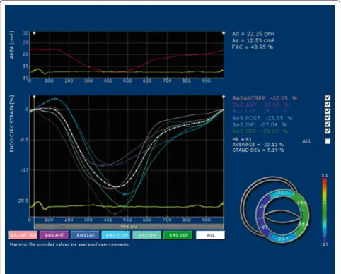Figure 1 Example of endocardial circumferential strain at basal level of LV assessed by X-Strain software (ESAOTE, Italy)