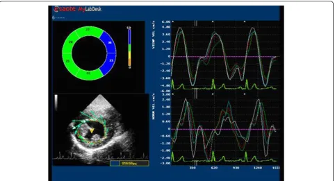 Figure 2 Example of endocadial basal rotation of LV assessed by X-Strain Software (ESAOTE, Italy).